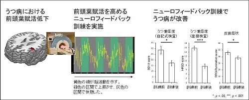うつ